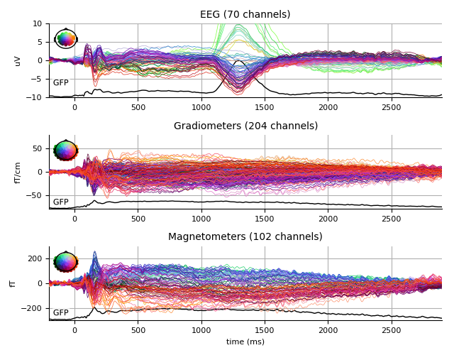 ../../_images/sphx_glr_plot_analysis_01_005.png