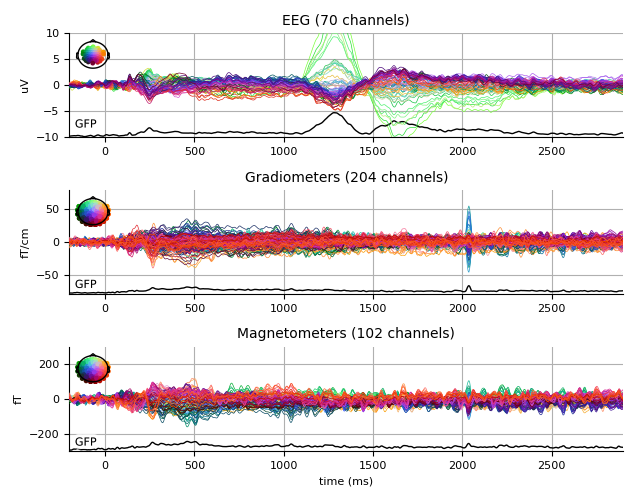 ../../_images/sphx_glr_plot_analysis_01_009.png