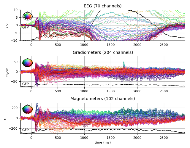 ../../_images/sphx_glr_plot_analysis_02_006.png