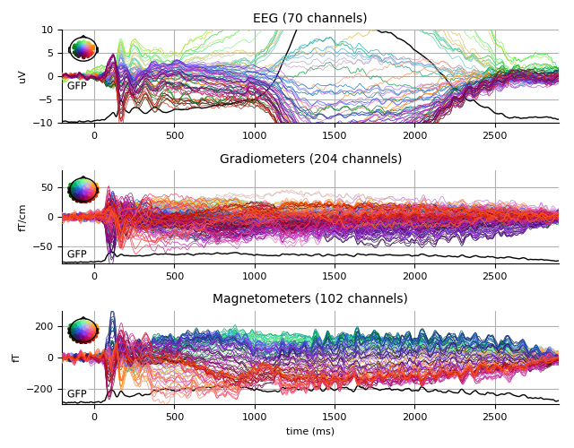 ../../_images/sphx_glr_plot_analysis_02_008.png