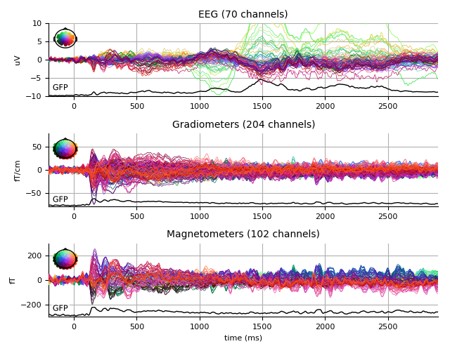 ../../_images/sphx_glr_plot_analysis_02_009.png