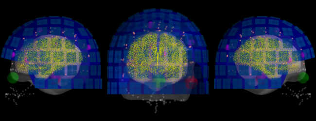 ../../_images/sphx_glr_plot_analysis_02_026.png