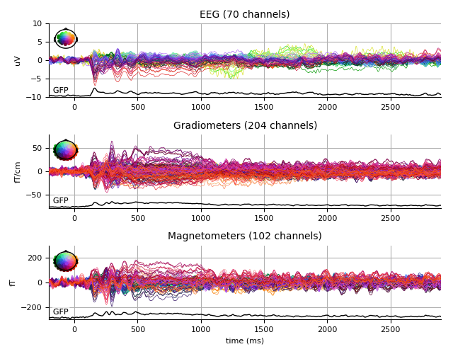 ../../_images/sphx_glr_plot_analysis_04_009.png