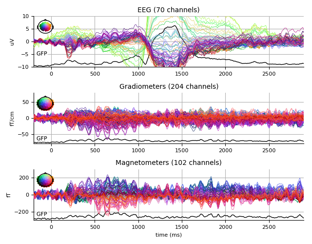 ../../_images/sphx_glr_plot_analysis_05_009.png