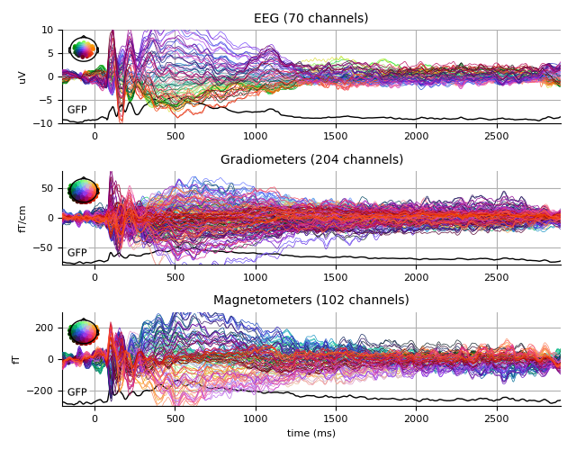 ../../_images/sphx_glr_plot_analysis_07_005.png