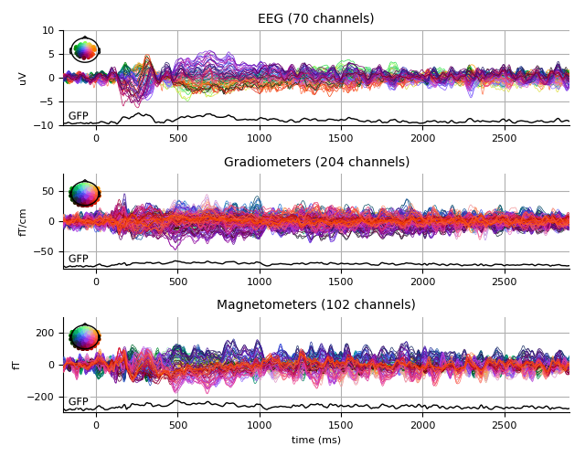 ../../_images/sphx_glr_plot_analysis_07_009.png