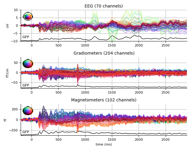 ../../_images/sphx_glr_plot_analysis_09_009.png