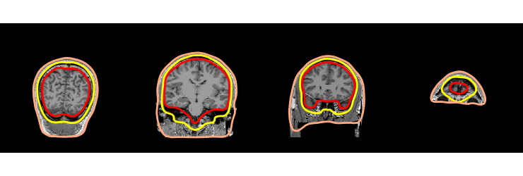 ../../_images/sphx_glr_plot_analysis_09_030.png