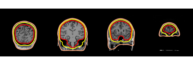 ../../_images/sphx_glr_plot_analysis_10_030.png