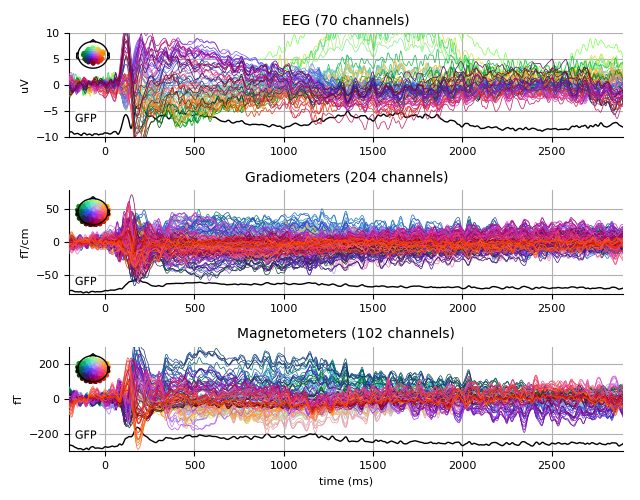 ../../_images/sphx_glr_plot_analysis_11_007.png