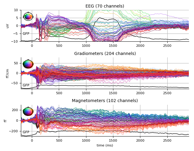 ../../_images/sphx_glr_plot_analysis_12_005.png