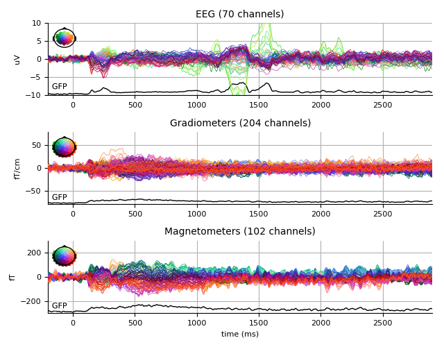 ../../_images/sphx_glr_plot_analysis_12_009.png