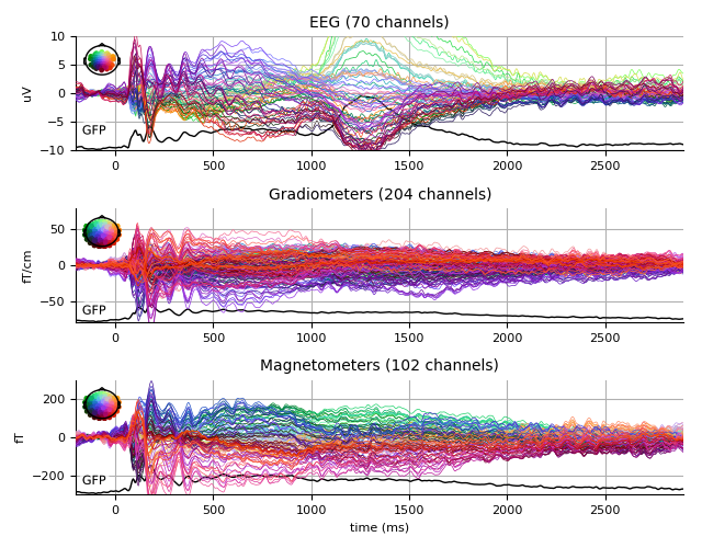 ../../_images/sphx_glr_plot_analysis_13_005.png