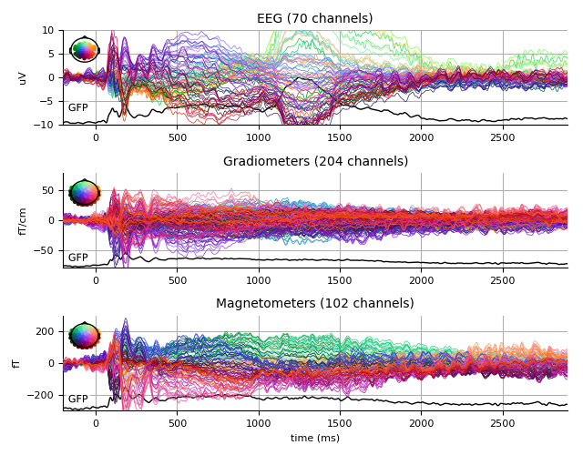 ../../_images/sphx_glr_plot_analysis_13_006.png