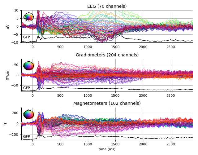 ../../_images/sphx_glr_plot_analysis_13_007.png