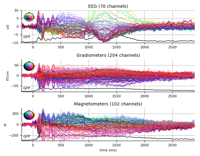 ../../_images/sphx_glr_plot_analysis_13_008.png