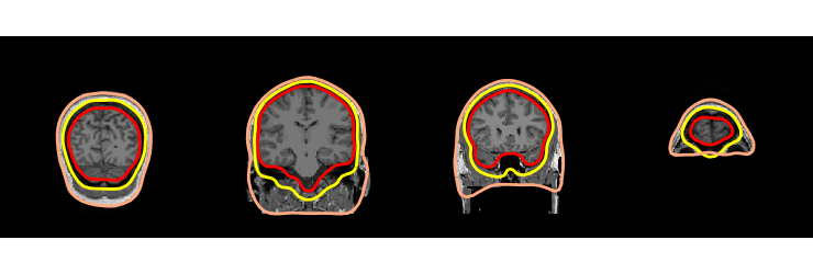 ../../_images/sphx_glr_plot_analysis_13_030.png