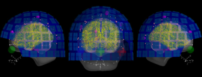 ../../_images/sphx_glr_plot_analysis_14_026.png