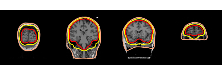 ../../_images/sphx_glr_plot_analysis_14_030.png