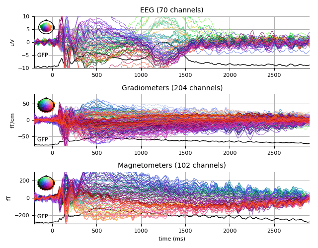 ../../_images/sphx_glr_plot_analysis_15_005.png