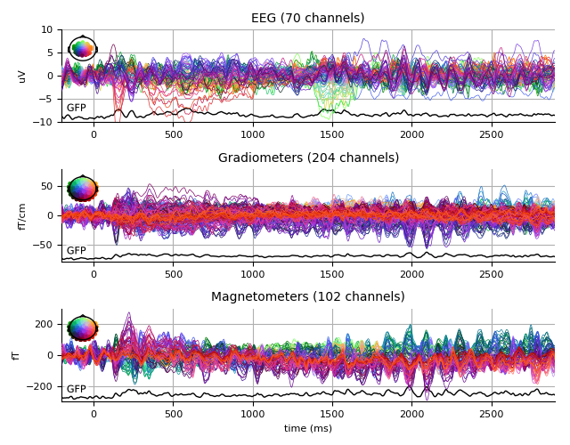 ../../_images/sphx_glr_plot_analysis_15_009.png