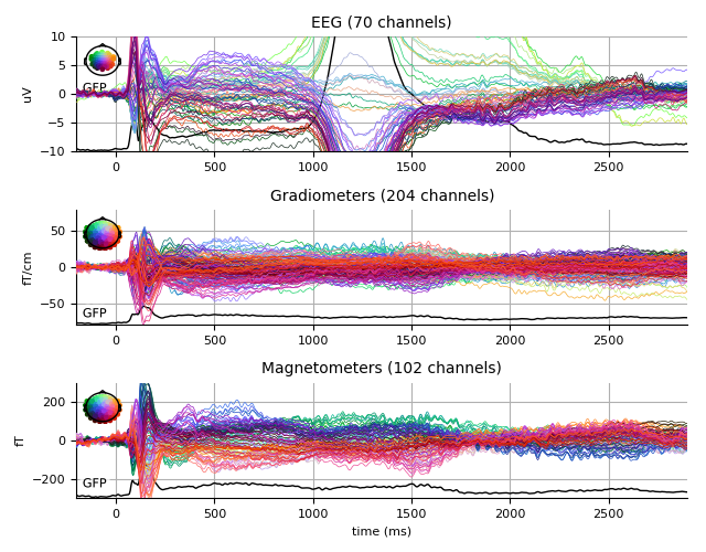 ../../_images/sphx_glr_plot_analysis_16_005.png