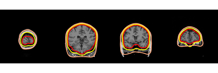 ../../_images/sphx_glr_plot_analysis_16_030.png