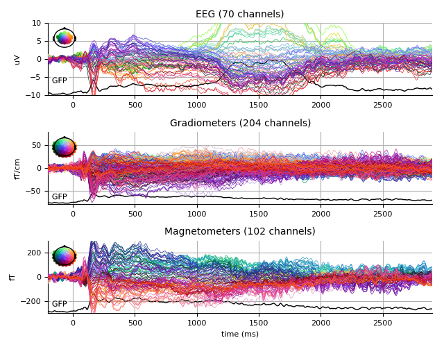 ../../_images/sphx_glr_plot_analysis_17_007.png