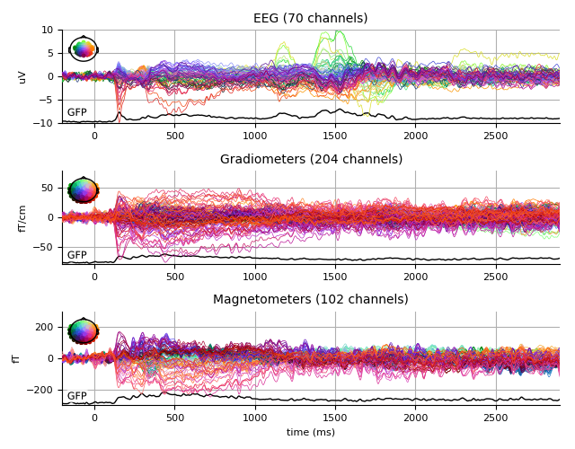 ../../_images/sphx_glr_plot_analysis_17_009.png