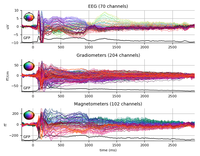 ../../_images/sphx_glr_plot_analysis_18_008.png