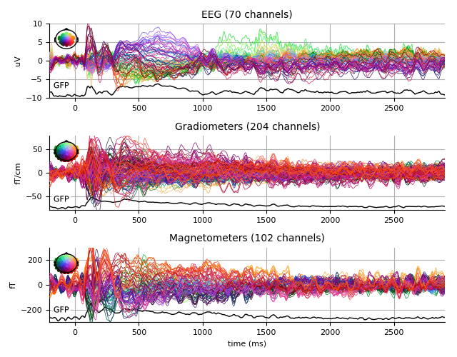 ../../_images/sphx_glr_plot_analysis_19_007.png