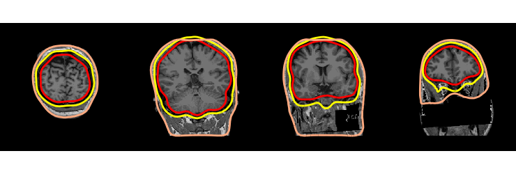 ../../_images/sphx_glr_plot_analysis_19_030.png