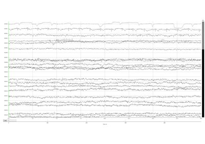 ../_images/sphx_glr_plot_ica_thumb.png