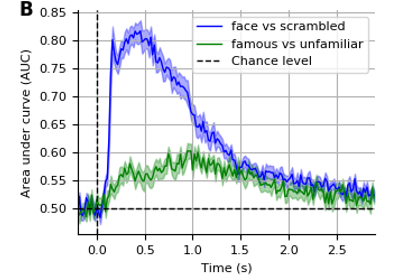 ../_images/sphx_glr_plot_sliding_estimator_thumb.png