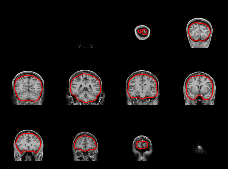 ../_images/sphx_glr_plot_bem_001.png