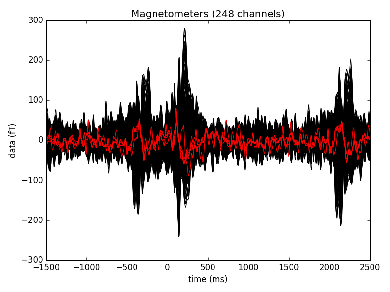 ../_images/sphx_glr_plot_interpolate_missing_channels_001.png