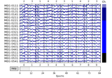 The Epochs data structure: discontinuous data