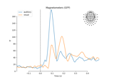 Overview of MEG/EEG analysis with MNE-Python