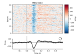 Visualizing epoched data