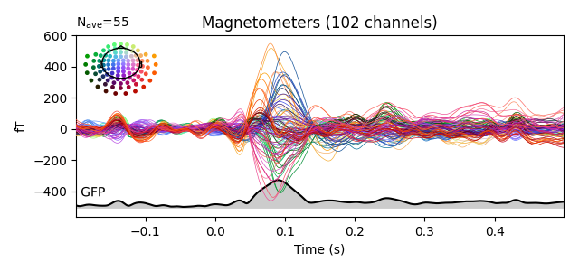 Magnetometers (102 channels)
