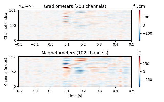 Gradiometers (203 channels), Magnetometers (102 channels), fT/cm, fT