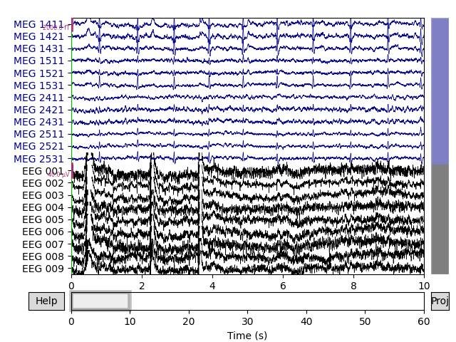 plot 40 artifact correction ica