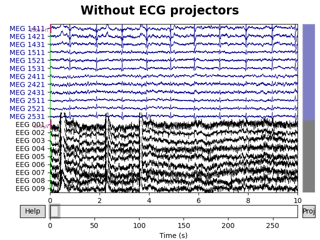 Without ECG projectors
