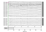 Setting the EEG reference