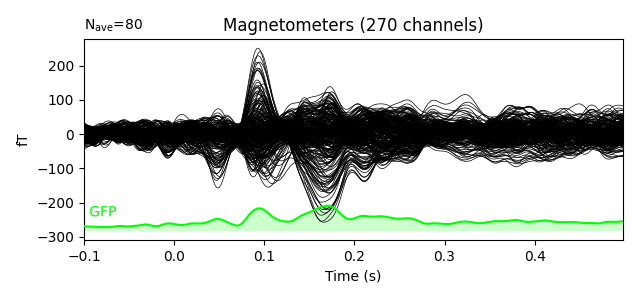 Magnetometers (270 channels)