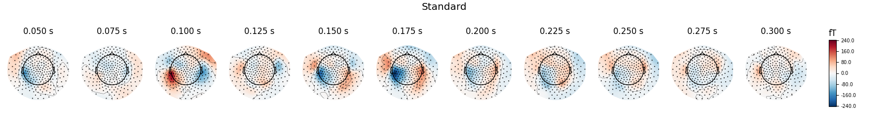 Standard, 0.050 s, 0.075 s, 0.100 s, 0.125 s, 0.150 s, 0.175 s, 0.200 s, 0.225 s, 0.250 s, 0.275 s, 0.300 s, fT