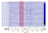 Brainstorm auditory tutorial dataset