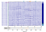 Brainstorm raw (median nerve) dataset