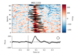 Visualize channel over epochs as an image