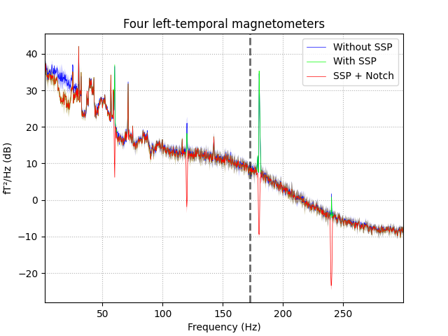 Four left-temporal magnetometers